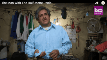 Un mexicano tiene un pene de casi medio metro