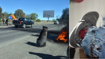 Así le quedó la pierna al diputado Godoy en la protesta.