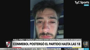 Así quedó el ojo izquierdo de Pérez.