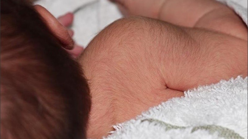 Los bebés dejaron de tomar el medicamento el crecimiento de cabello disminuyó.