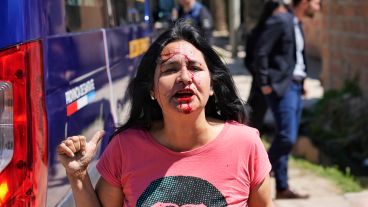 La vecina agredida con sangre en su rostro