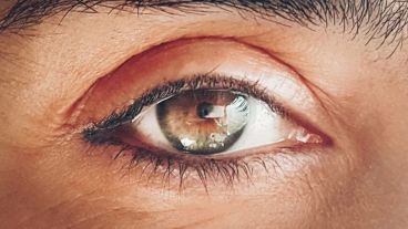 Se estima que 78 millones de personas viven actualmente con glaucoma en todo el mundo. 