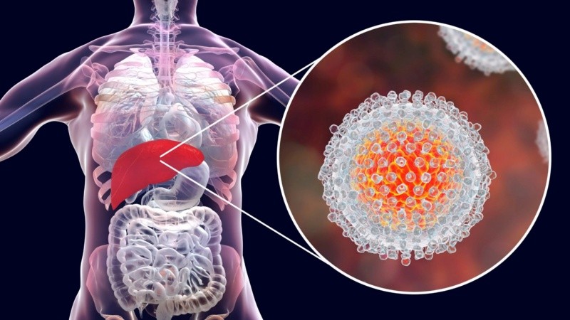 Los investigadores observaron que el tratamiento reducía la carga de enfermedad fibrótica y el riesgo de que evolucione a cáncer o cirrosis.